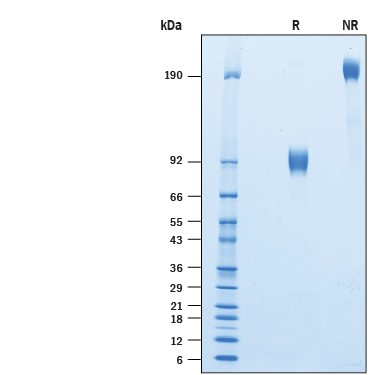 ビオチン標識ヒトSIRPα/CD172a組換え体タンパク質（#BT4546B）のSDS-PAGE解析