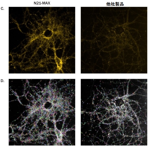 N21-MAXは神経細胞を発達させる（比較図）