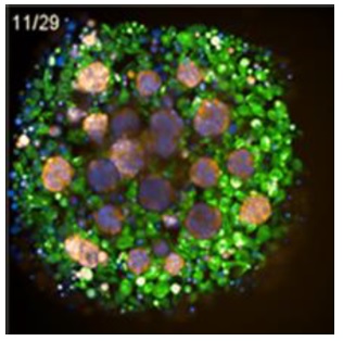 ChromaLiveによる初代培養がん細胞オルガノイドの染色