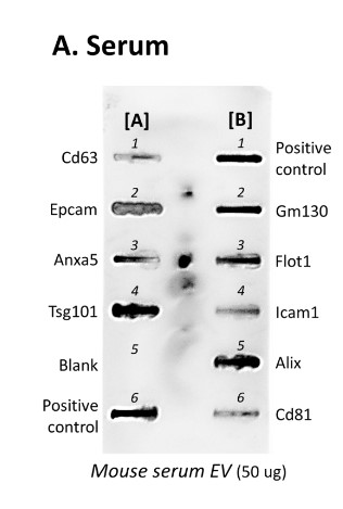mouse serum exosome Exo-Check Exosome Antibody Array