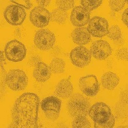 レンチウイルスの電子顕微鏡画像イメージ