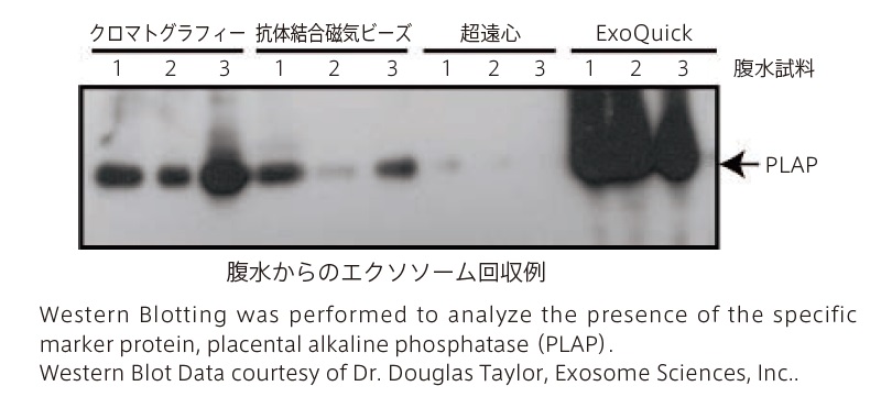 Exosome(エキソソーム、エクソソーム)濃縮用試薬 ExoQuick Exosome Precipitation Solution