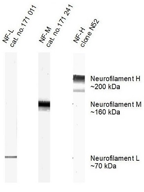 マウス脳組織ホモジネート中のNF-L/M/Hの検出