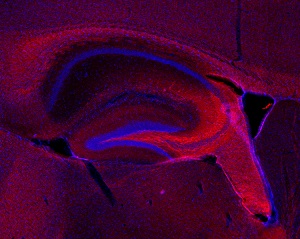 PFA固定マウス海馬組織切片におけるNF-Lの免疫蛍光染色像
