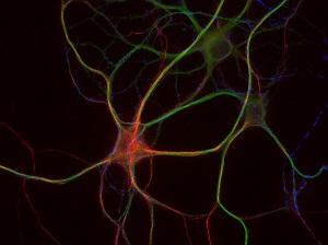 PFA固定ラット海馬ニューロンにおけるNF-Hの免疫蛍光染色像