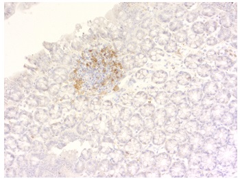 マウス脾臓切片のCD4とCD8免疫組織染色像
