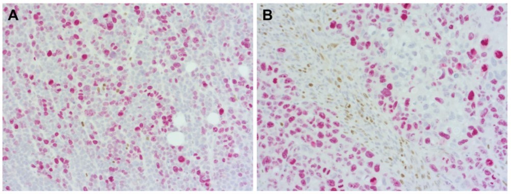 #HS-398003および#HS-398117を用いた異種移植マウス組織の二重染色像-1