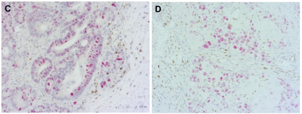#HS-398003および#HS-398117を用いた異種移植マウス組織の二重染色像-2
