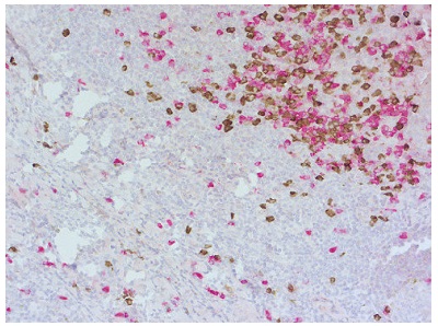 ヒト扁桃腺（ホルマリン固定パラフィン包埋）の二重免疫染色像