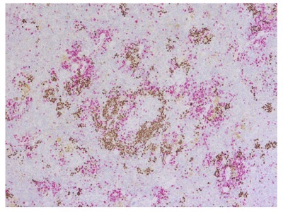 抗ヒトおよび抗マウスKi67抗体を用いたヒト化マウス脾臓の二重免疫染色像