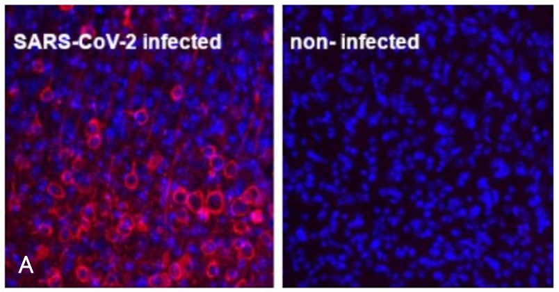 #HS-452111を用いたマウス脳組織の免疫蛍光染色像-1