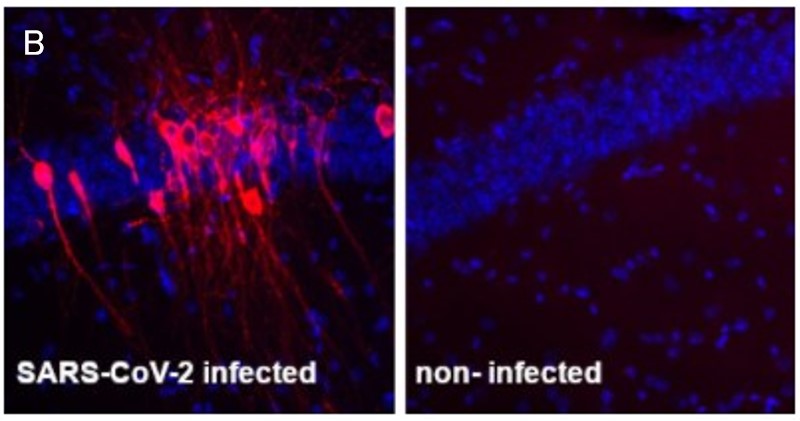 #HS-452111を用いたマウス脳組織の免疫蛍光染色像-2