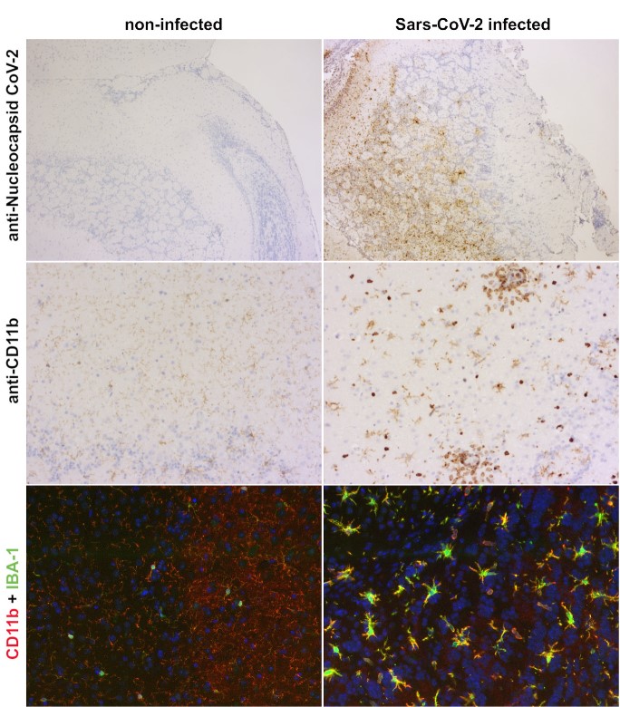 SARS-CoV-2に感染したK18 hACE2トランスジェニックマウス脳組織の免疫／免疫蛍光染色像
