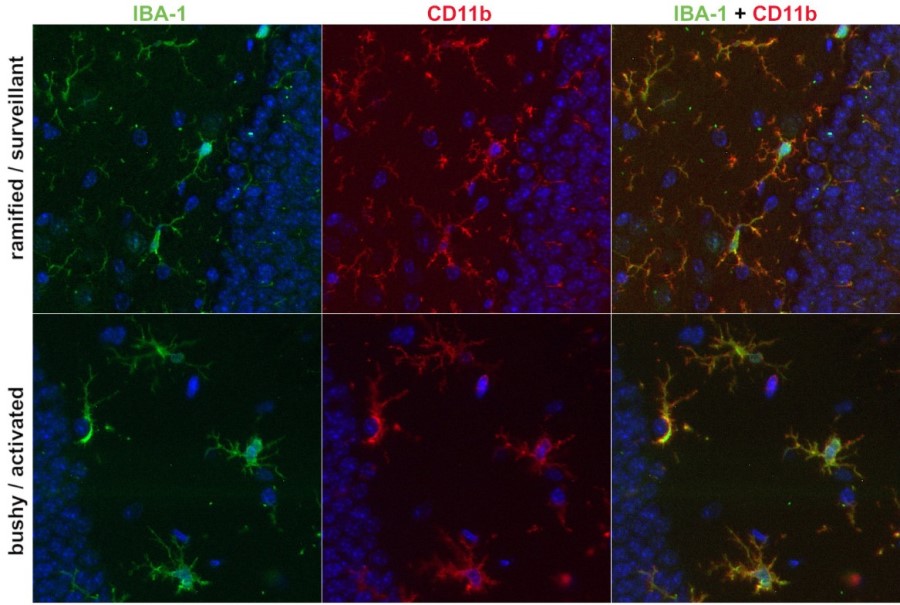 野生型マウス脳組織のラミファイド型ミクログリアとSARS-CoV-2ウイルスに感染したマウス脳組織のbushy型ミクログリア