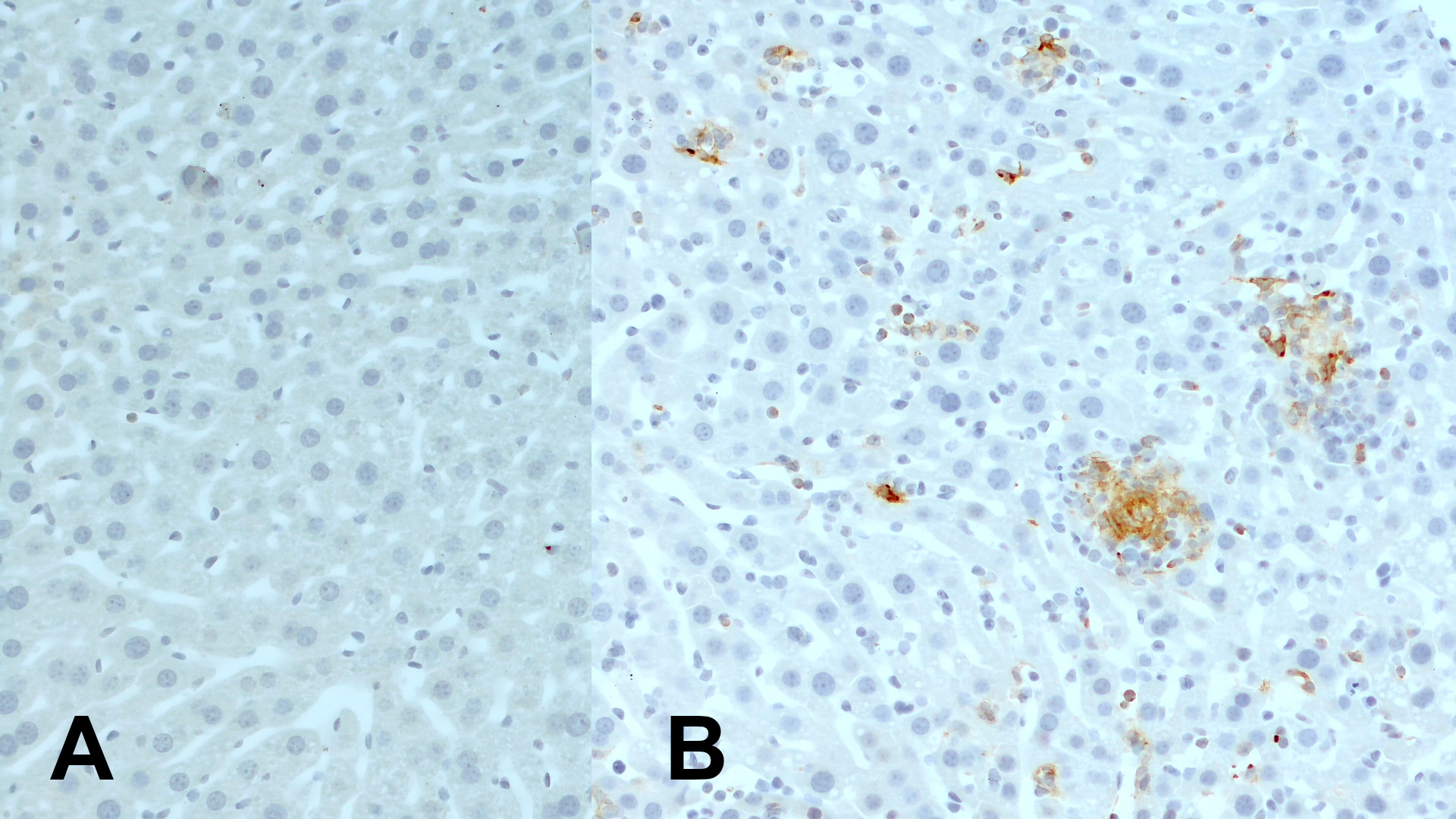 抗CD11c抗体（#HS-375003）を用いたマウス肝組織の免疫組織染色像
