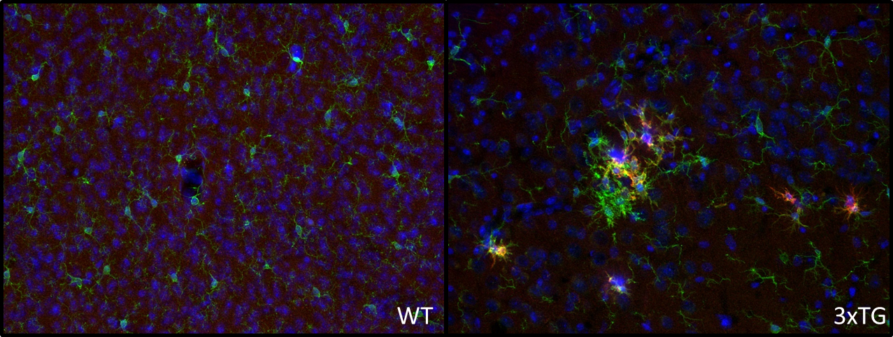 抗CD11c抗体（#HS-375004）トリプルトランスジェニックアルツハイマー病マウスの脳皮質組織の免疫組織染色像