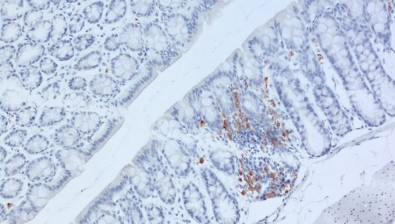 抗CD11c抗体（#HS-375003）を用いたマウス結腸組織の免疫組織染色像