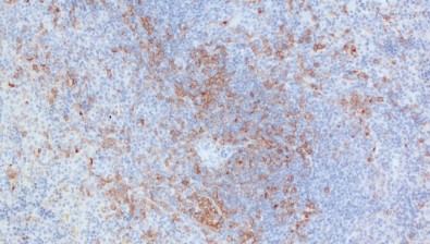 抗CD11c抗体（#HS-375004)を用いたマウス脾臓組織の免疫組織染色像