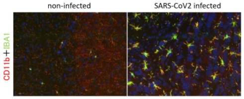 SARS-CoV-2ウイルスに感染したマウス脳組織のミクログリアにおけるCD11bとIBA1の発現