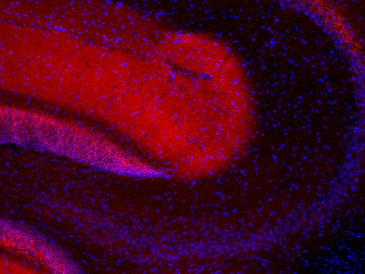 PFA固定マウス海馬切片の免疫組織染色像