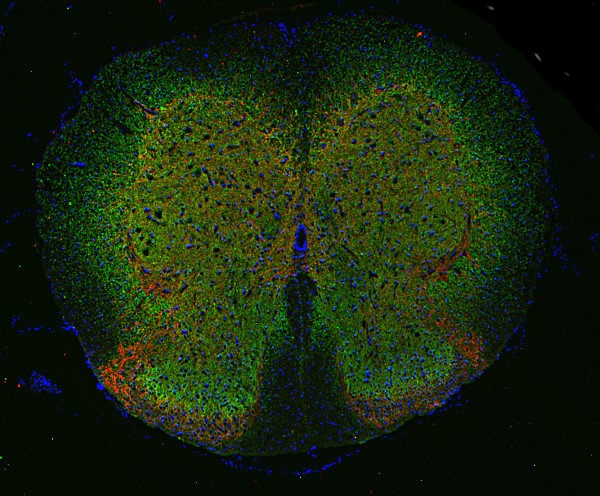 PFA固定パラフィン包埋マウス脊髄切片の免疫組織染色像