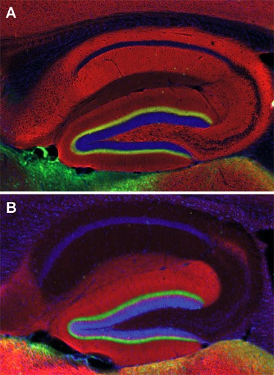 マウス海馬切片の免疫組織染色像