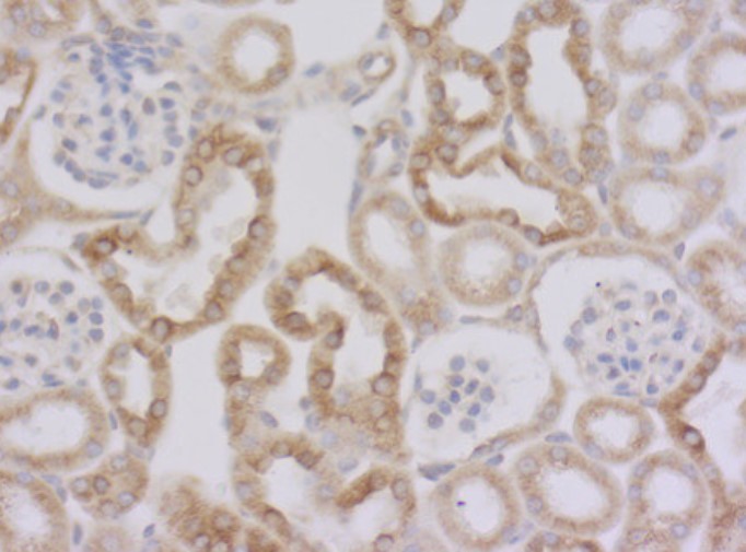 マウス腎臓組織の免疫染色像
