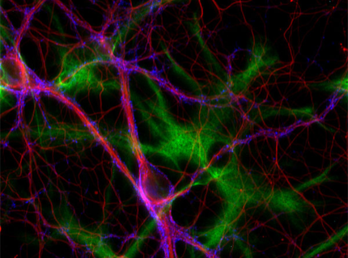 ラット海馬ニューロンおよびアストロサイトの蛍光染色像