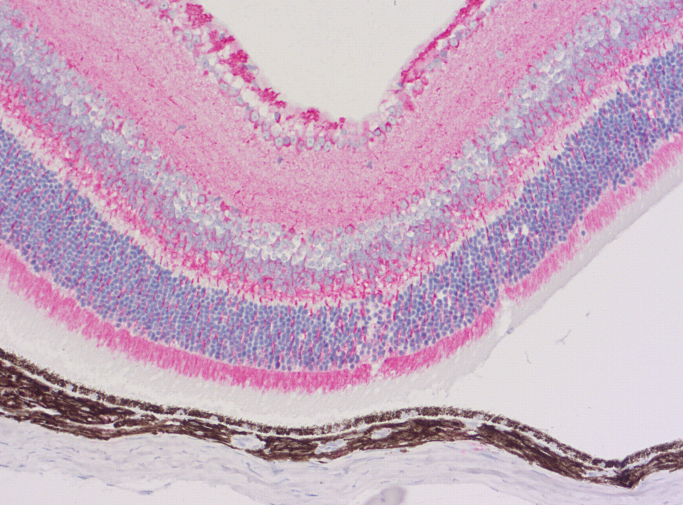マウス眼球切片の免疫蛍光染色像