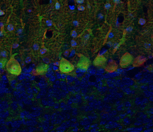 GAD67-GFPを発現するトランスジェニックマウス免疫組織染色像
