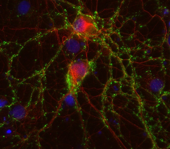 ニューロン発達関連抗体使用例2