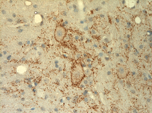 抗GAD 1 / GAD 67抗体を用いたマウス小脳の免疫染色像2