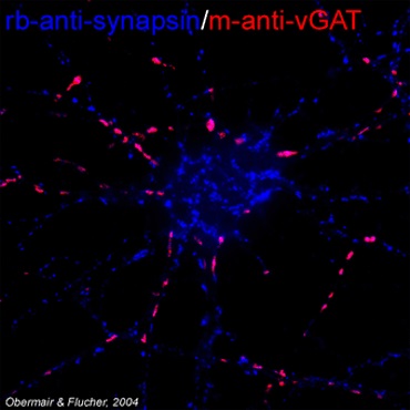 抗VGAT抗体および抗シナプシン抗体を用いた免疫染色像