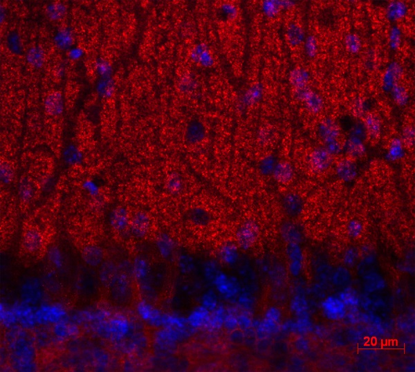 Ca2 channelのマウス小脳の免疫蛍光染色像