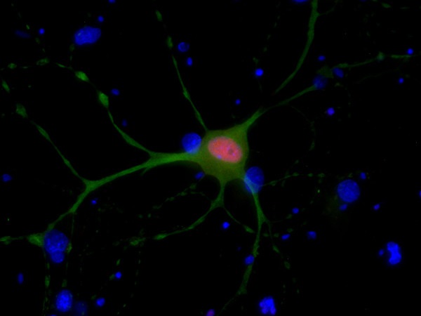 Ctip 2抗体による海馬ニューロンの免疫蛍光染色像