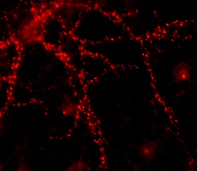 Homer 1抗体によるラット海馬ニューロンの免疫蛍光染色像
