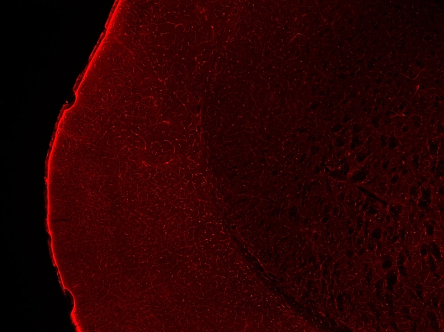 抗Aquaporin4抗体免疫組織染色（免疫組織染色）イメージ