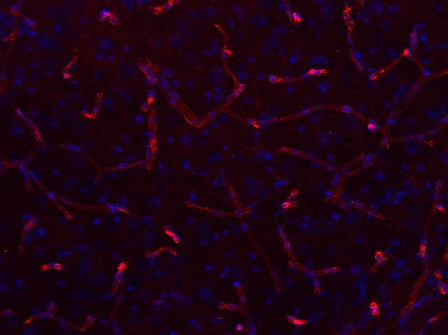 抗Aquaporin4抗体免疫組織染色（免疫組織染色）イメージ