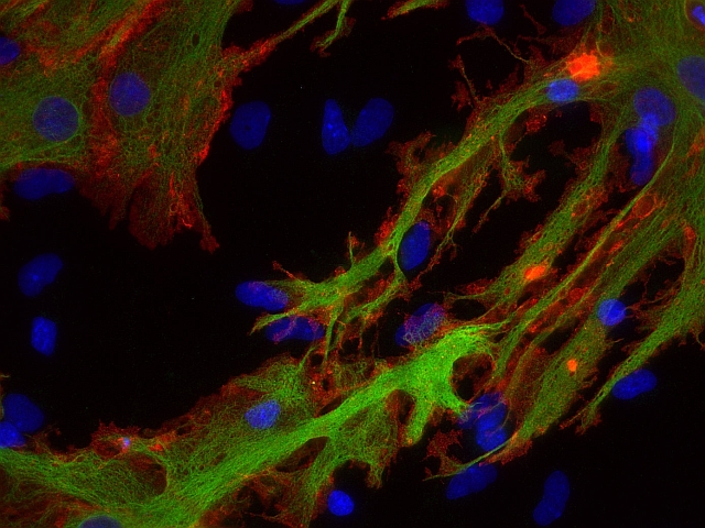 抗Aquaporin4抗体免疫組織染色（免疫細胞染色）イメージ