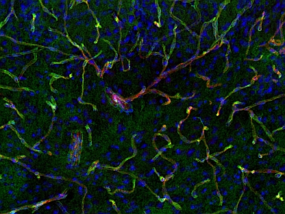 抗CD31抗体によるマウス大脳の免疫組織染色像