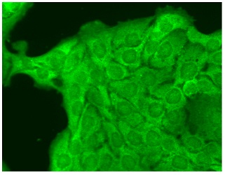 抗Nav1.8抗体 (#SMC-342D)を用いたHaCaT細胞の蛍光免疫染色像