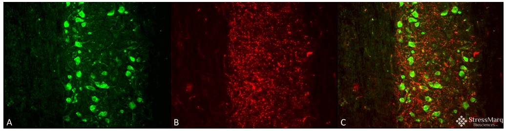 抗VGLUT1抗体 (#SMC-394)を用いたiPSC由来皮質興奮性神経細胞の蛍光免疫染色像