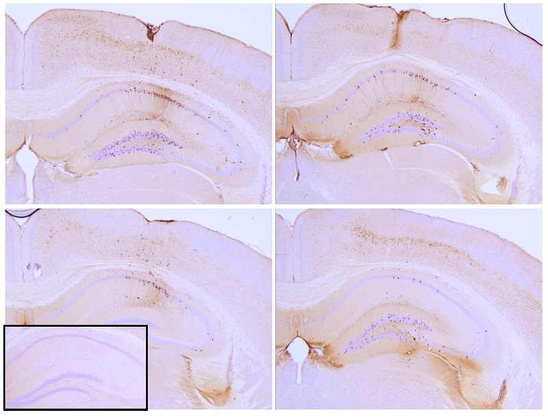 18 P301LタウPFF（SPR-330）を注射したP301Lマウス海馬の蛍光免疫染色像