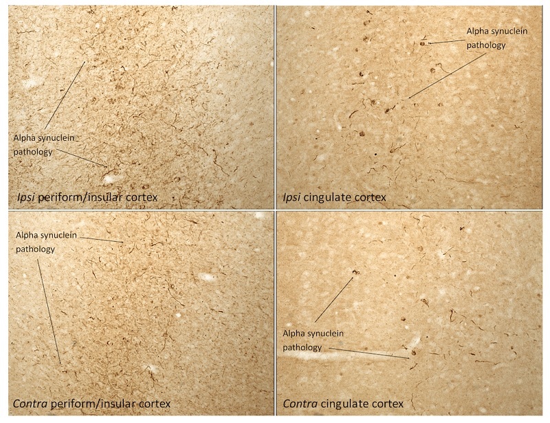 Type 1マウスα-シヌクレインPFF（#SPR-324）を注射したラット脳の免疫組織化学染色像