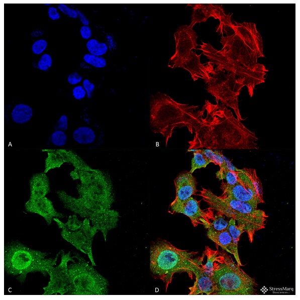 抗GFAP抗体を用いた神経芽細胞腫細胞株SK-N-BEの蛍光免疫染色像