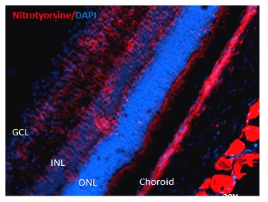 抗Nitrotyrosine Antibody抗体を用いたマウス網膜損傷モデルの蛍光免疫染色像