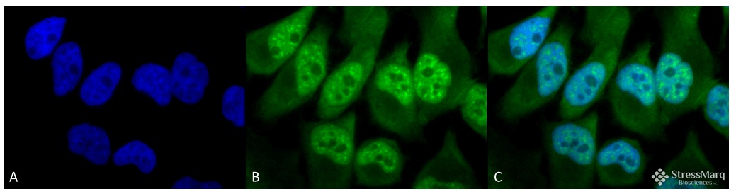 抗Phosphothreonine抗体 (#SPC-154F)を用いたHeLa細胞の蛍光免疫染色像
