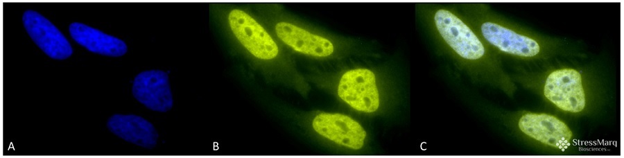 Anti-Acetylated Lysine Antibody (#SPC-155D)を用いたHeLa細胞の免疫染色像