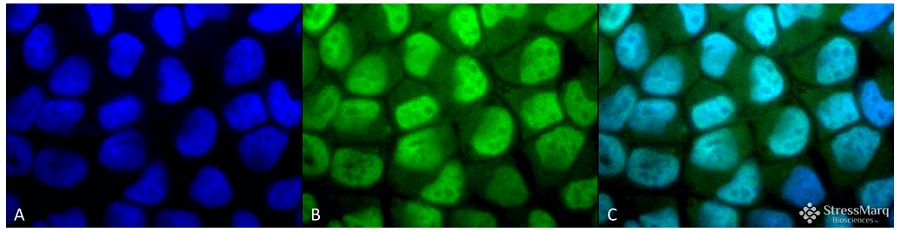 抗メチル化リジン抗体 (#SPC-158D)を用いたHeLa細胞の免疫染色像
