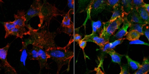 抗Acrolein抗体 (#SMC-504)を用いたヒト胎児腎細胞（HEK293）の蛍光免疫染色像